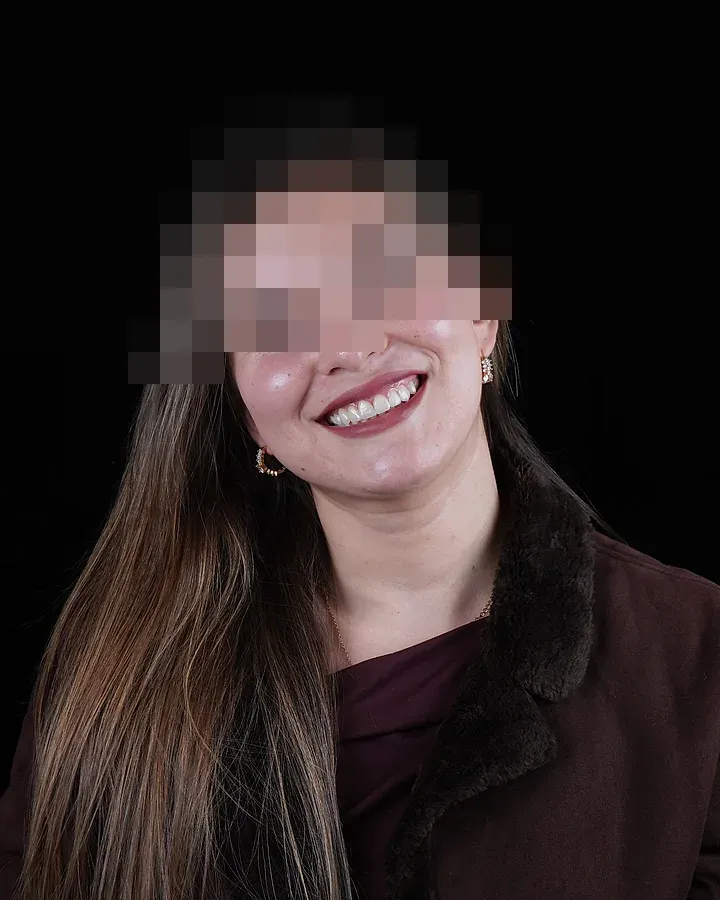 Paciente sonriendo al terminar su tratamiento, con los ojos pixelados